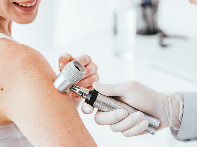 Cildiye (Dermatoloji)