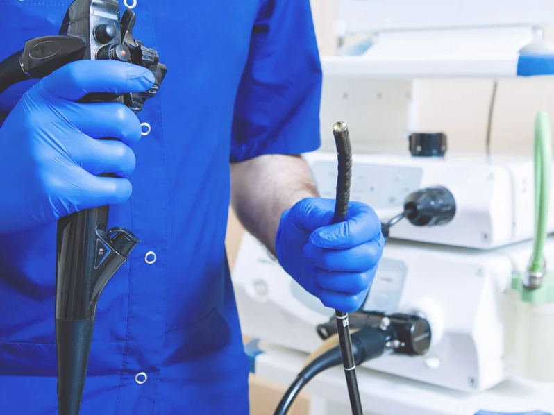 Kolonoskopi (Endoskopi)